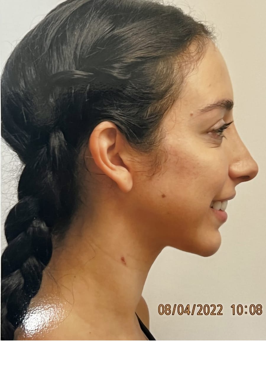 Case Study 63 after