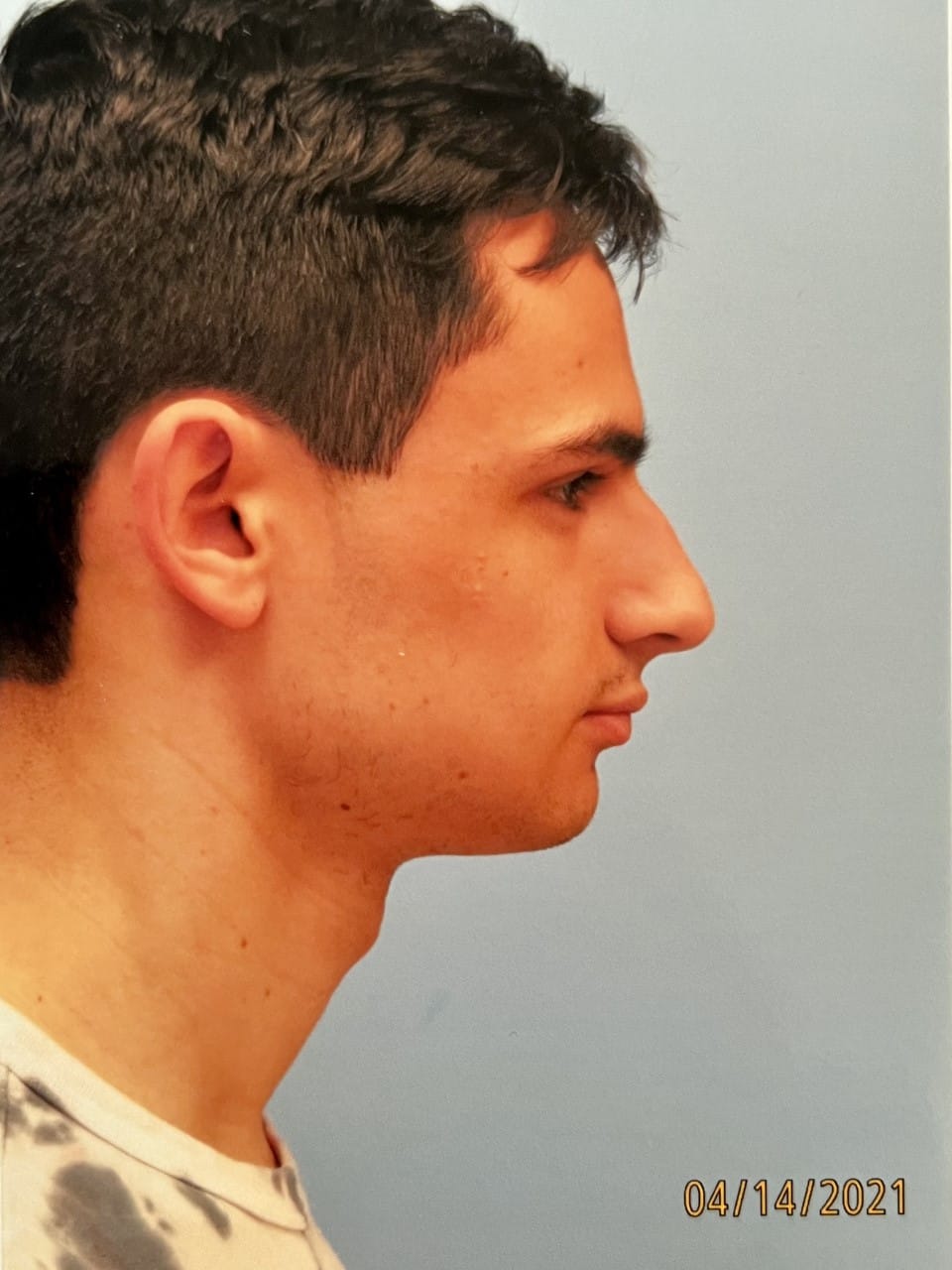 Case Study 48 — before and after