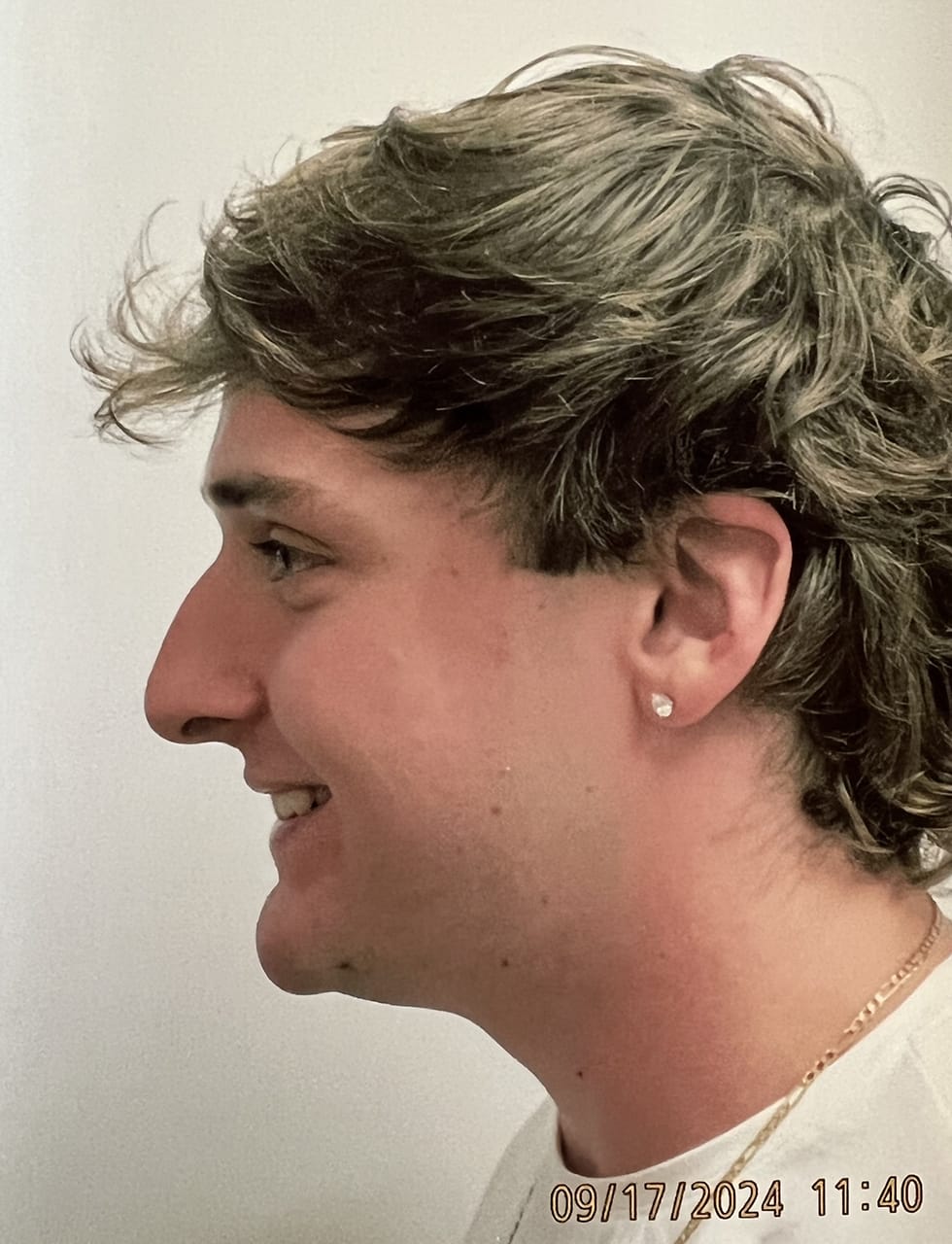 Case Study 248 — before and after