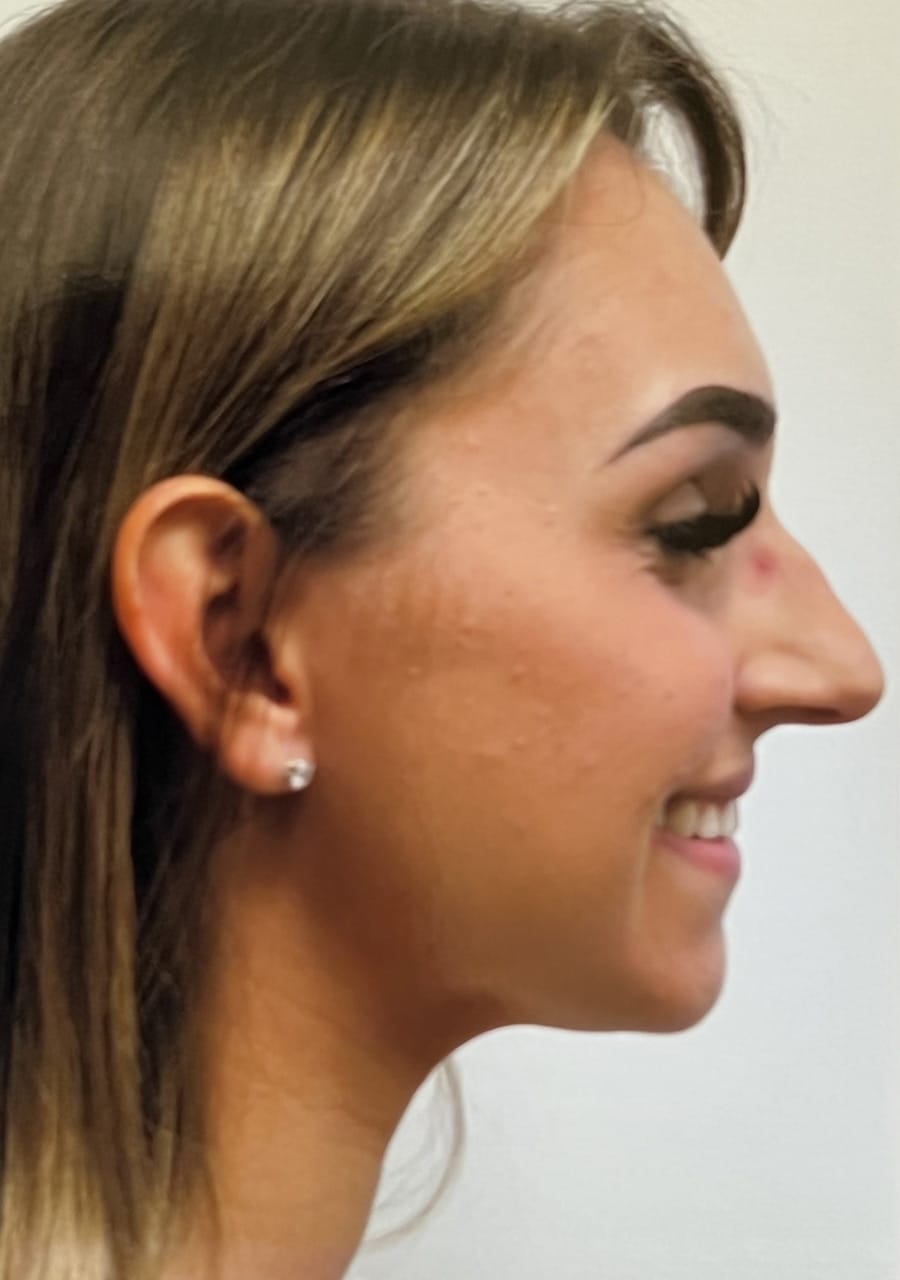 Case Study 96 — before and after