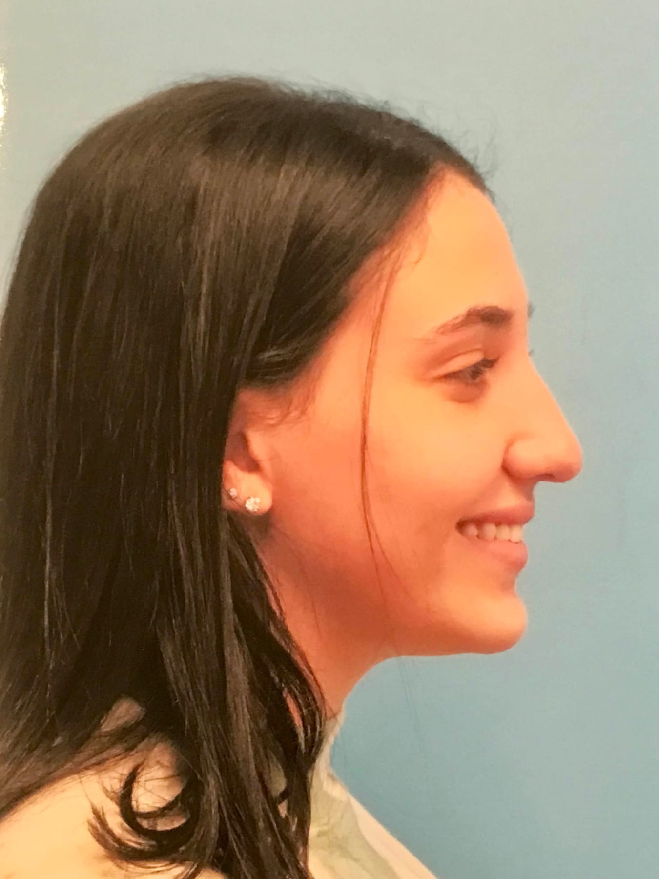 Case Study 28 — before and after