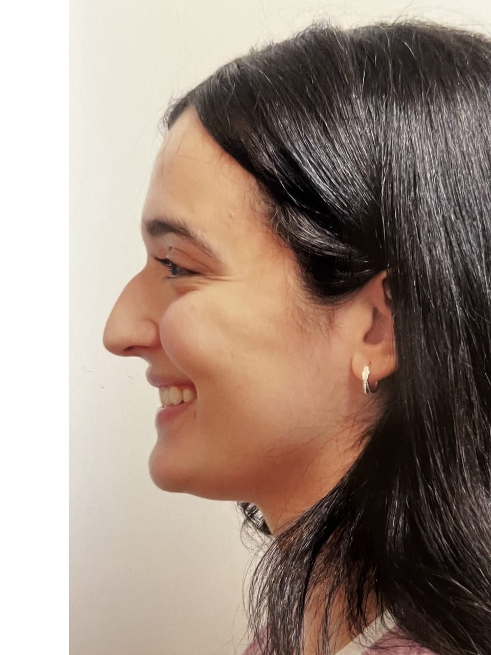 Case Study 250 — before and after