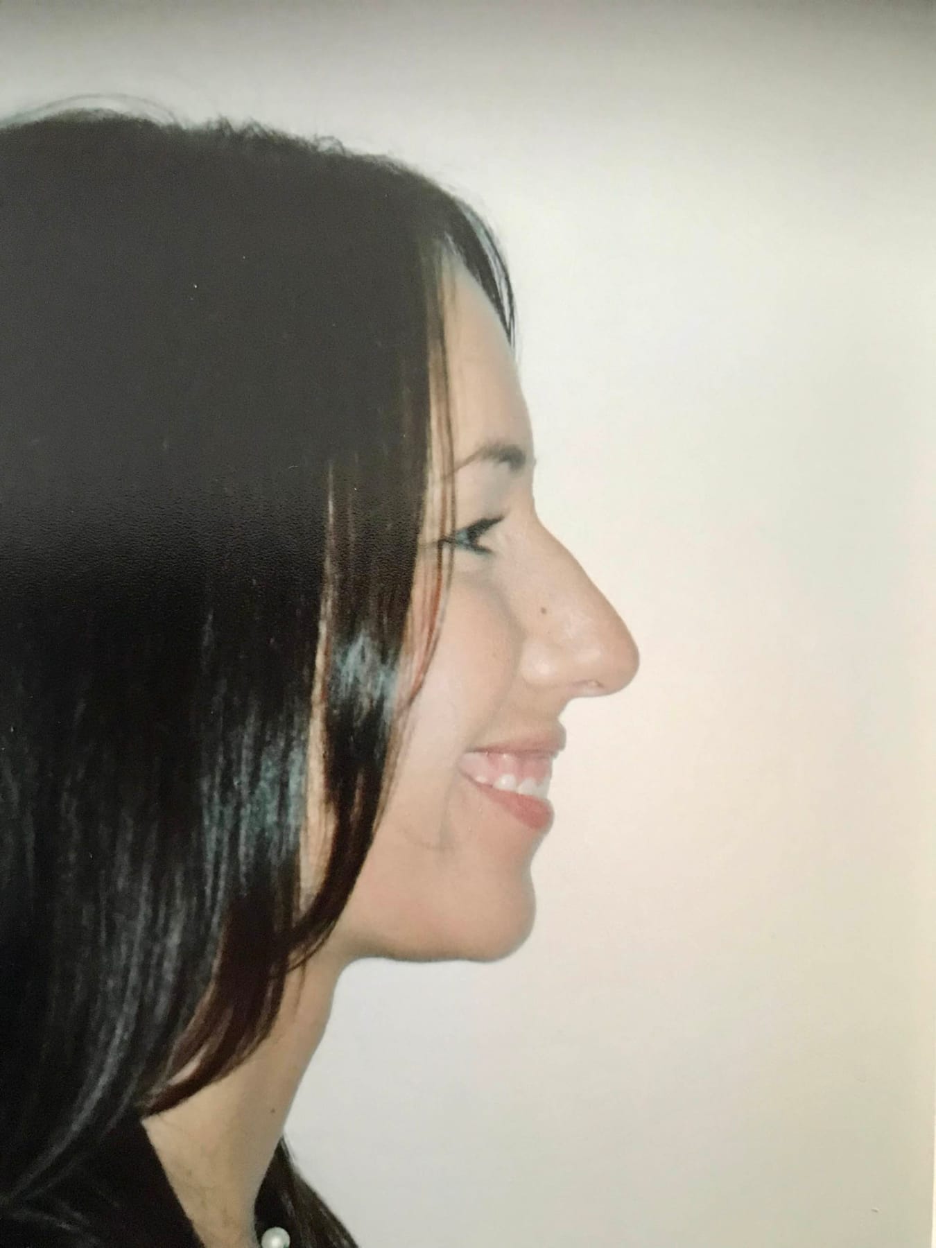 Case Study 40 — before and after