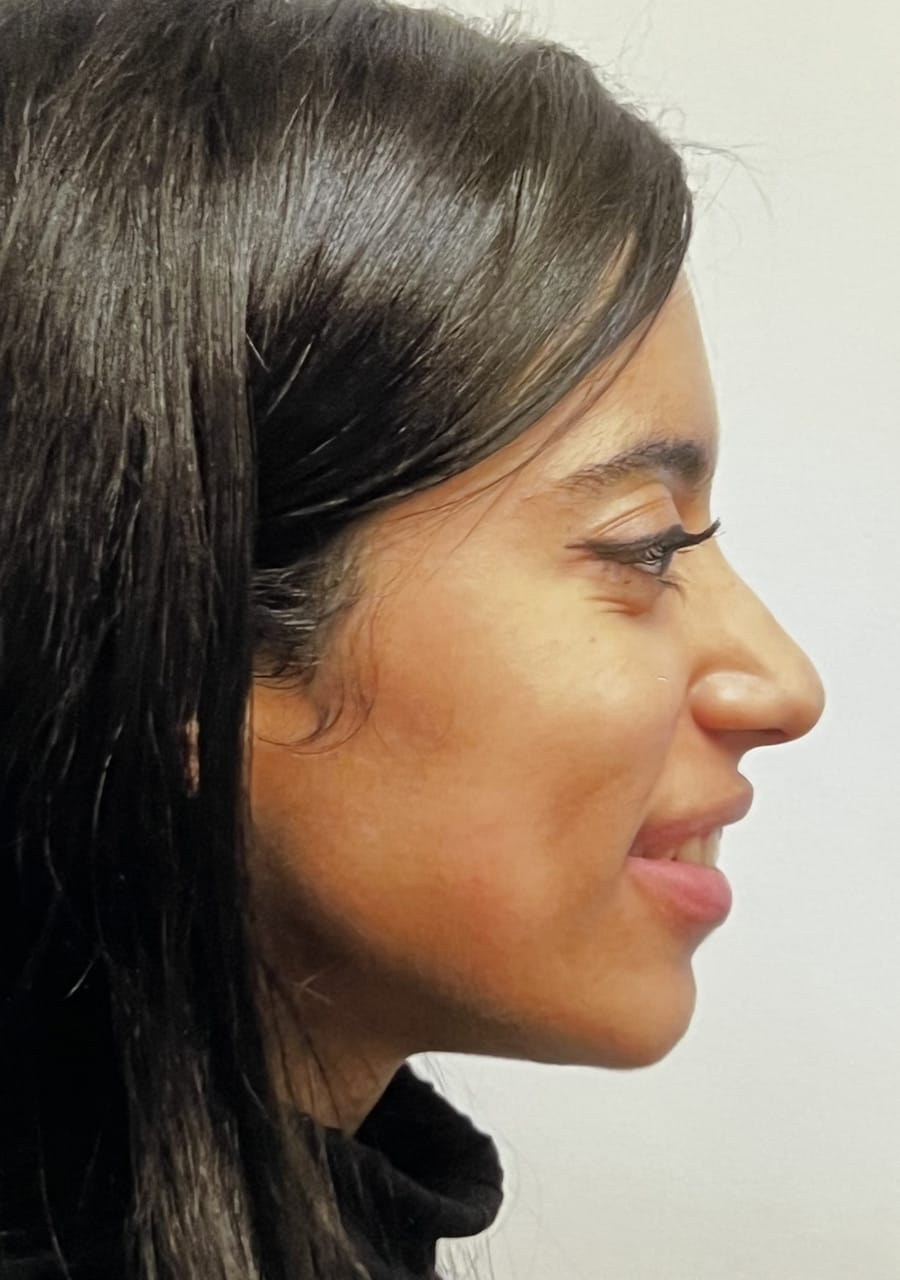 Case Study 95 — before and after