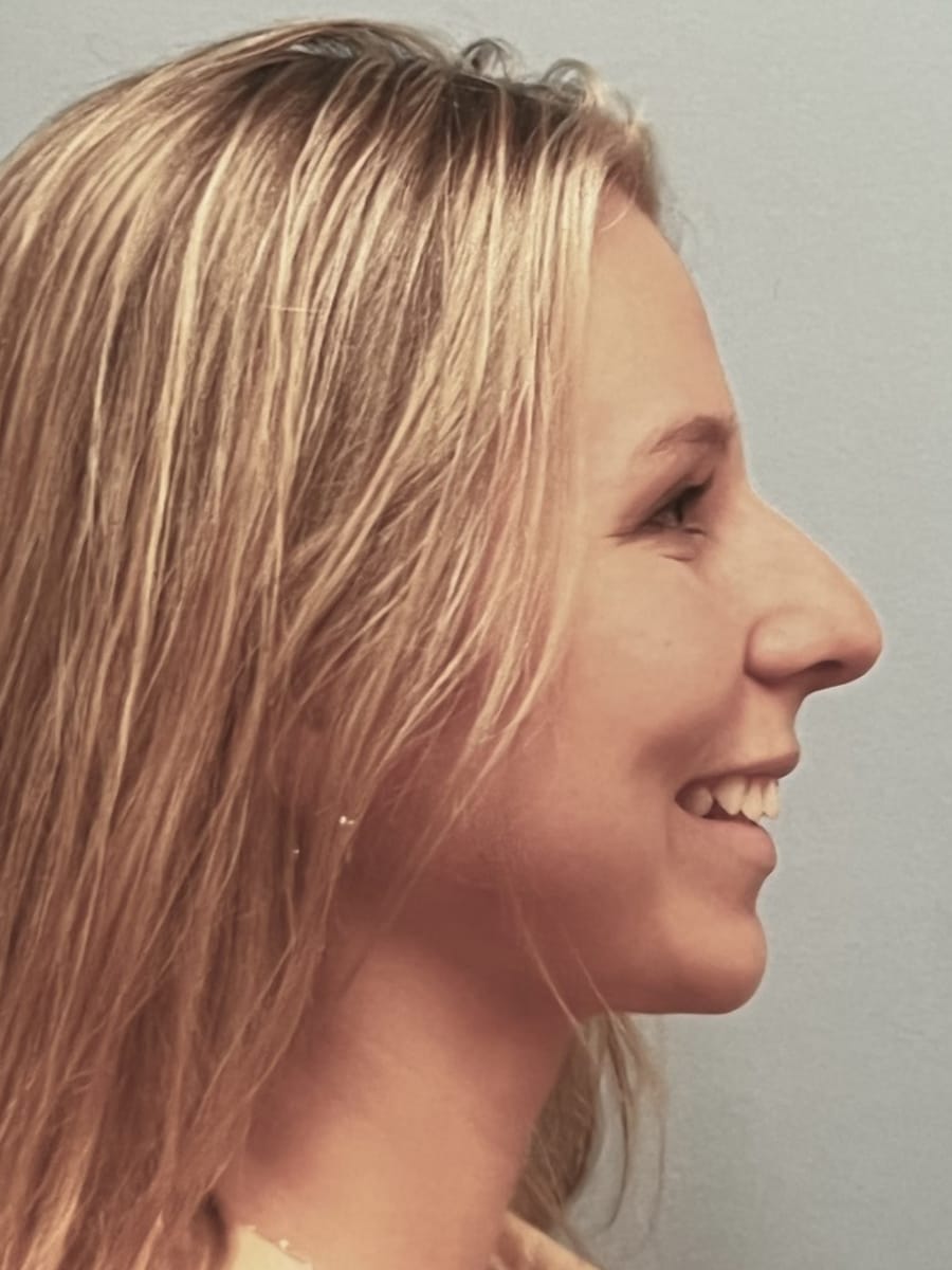 Case Study 75 — before and after