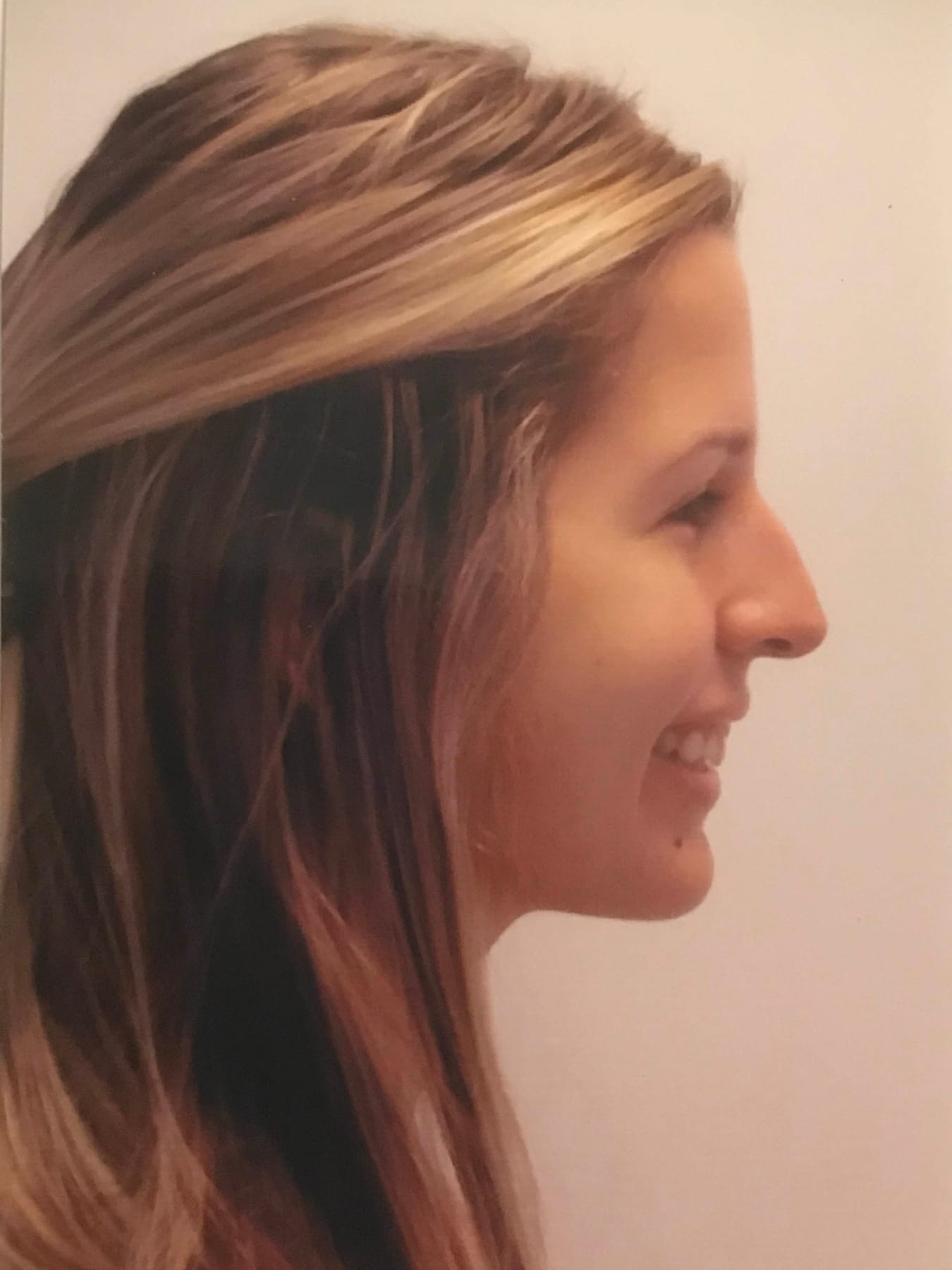 Case Study 34 — before and after