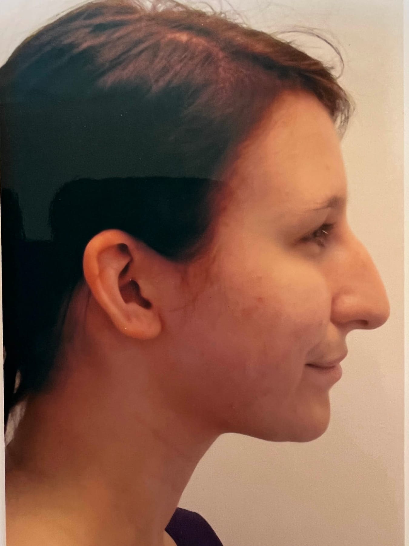 Case Study 46 — before and after