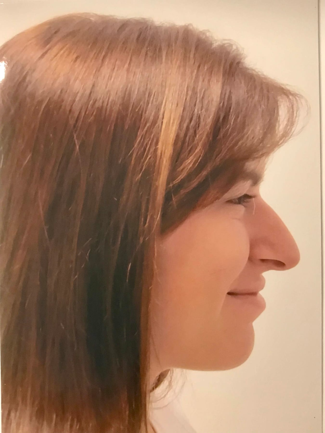 Case Study 26 — before and after