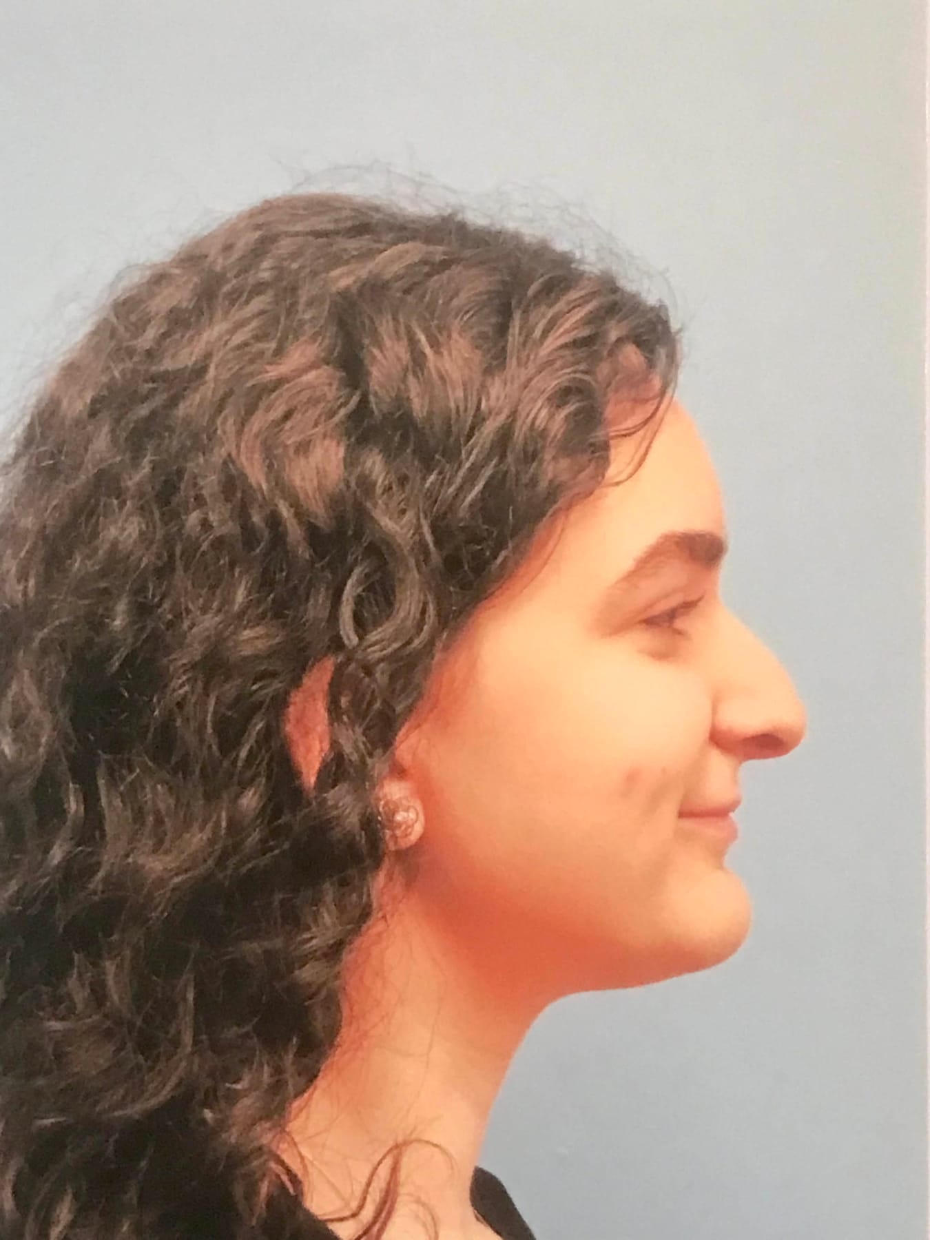 Case Study 30 — before and after