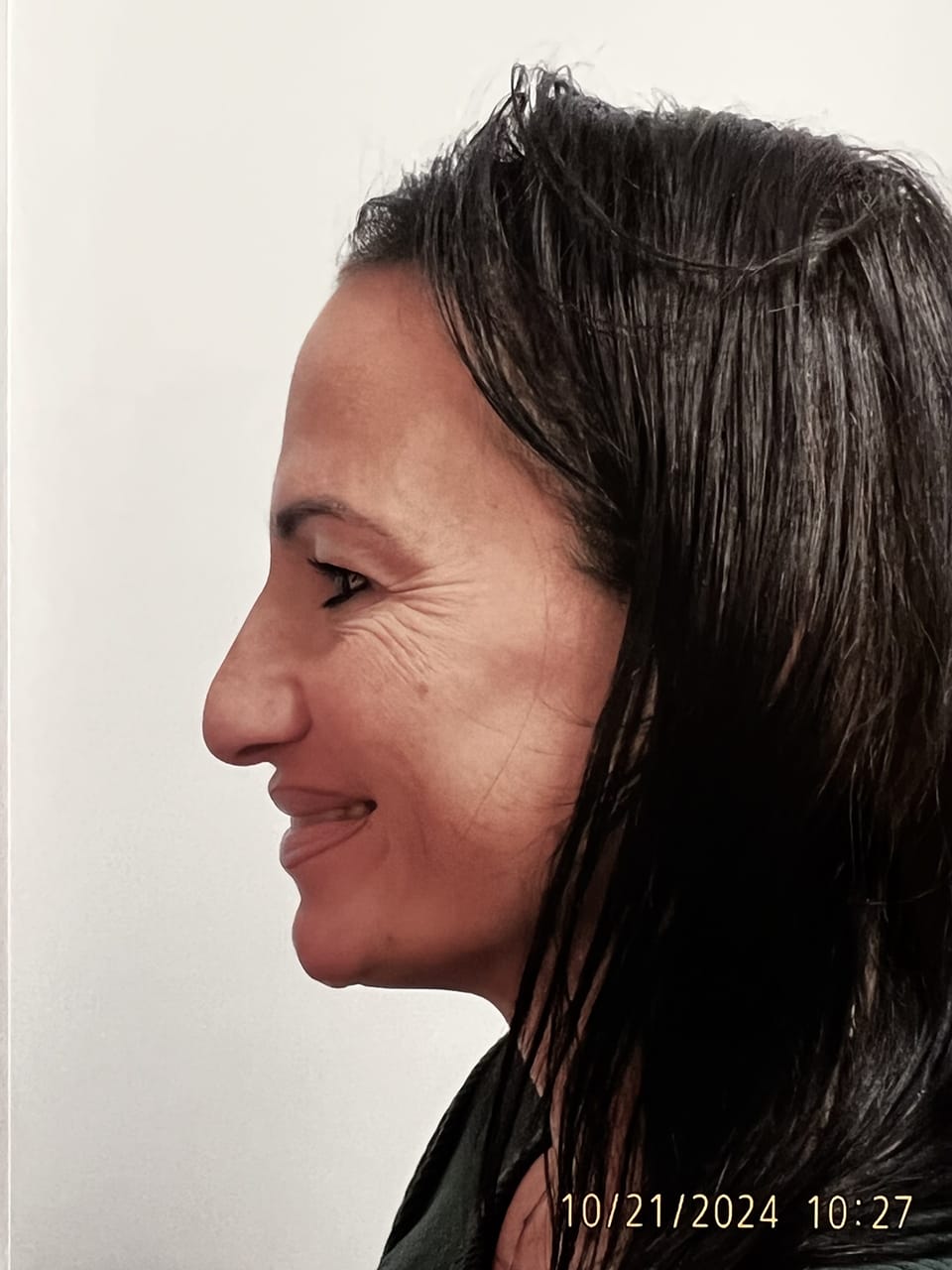 Case Study 243 — before and after