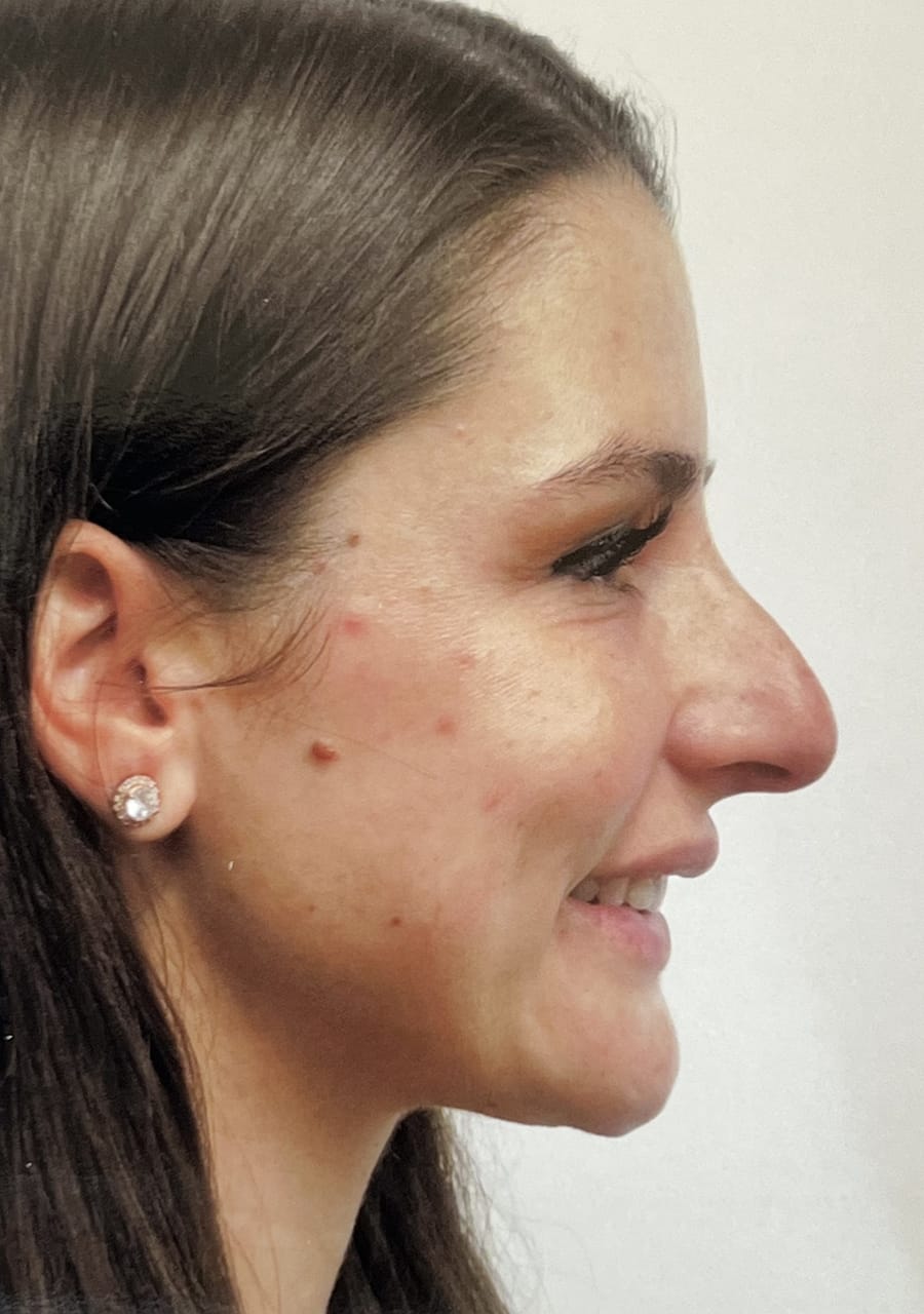 Case Study 108 — before and after