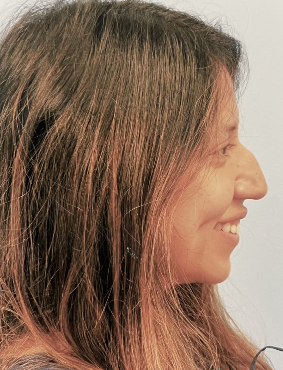 Case Study 59 — before and after