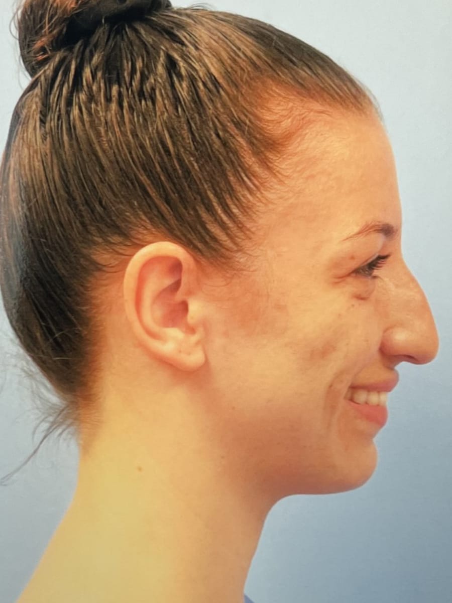 Case Study 79 — before and after