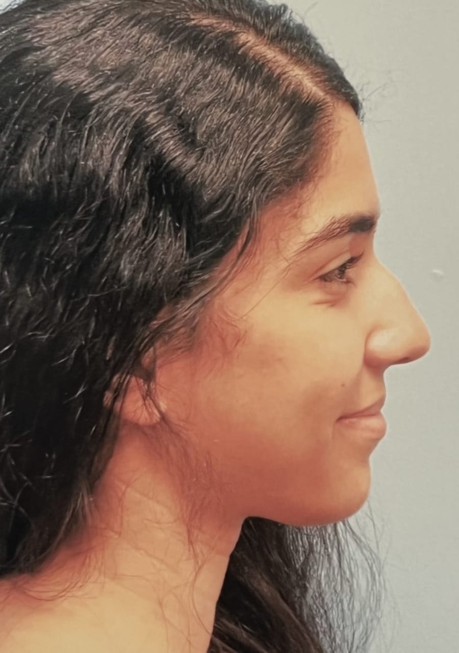 Case Study 67 — before and after