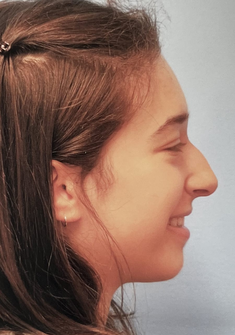 Case Study 102 — before and after