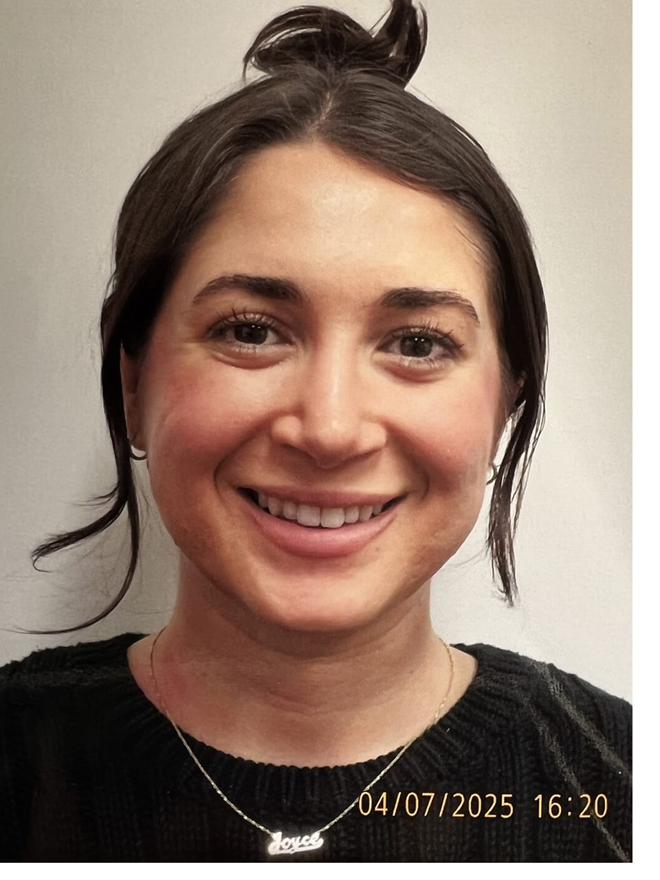 Case Study 261 after