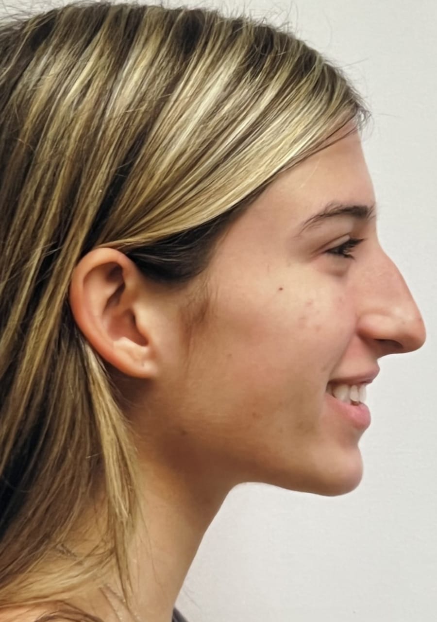 Case Study 91 — before and after