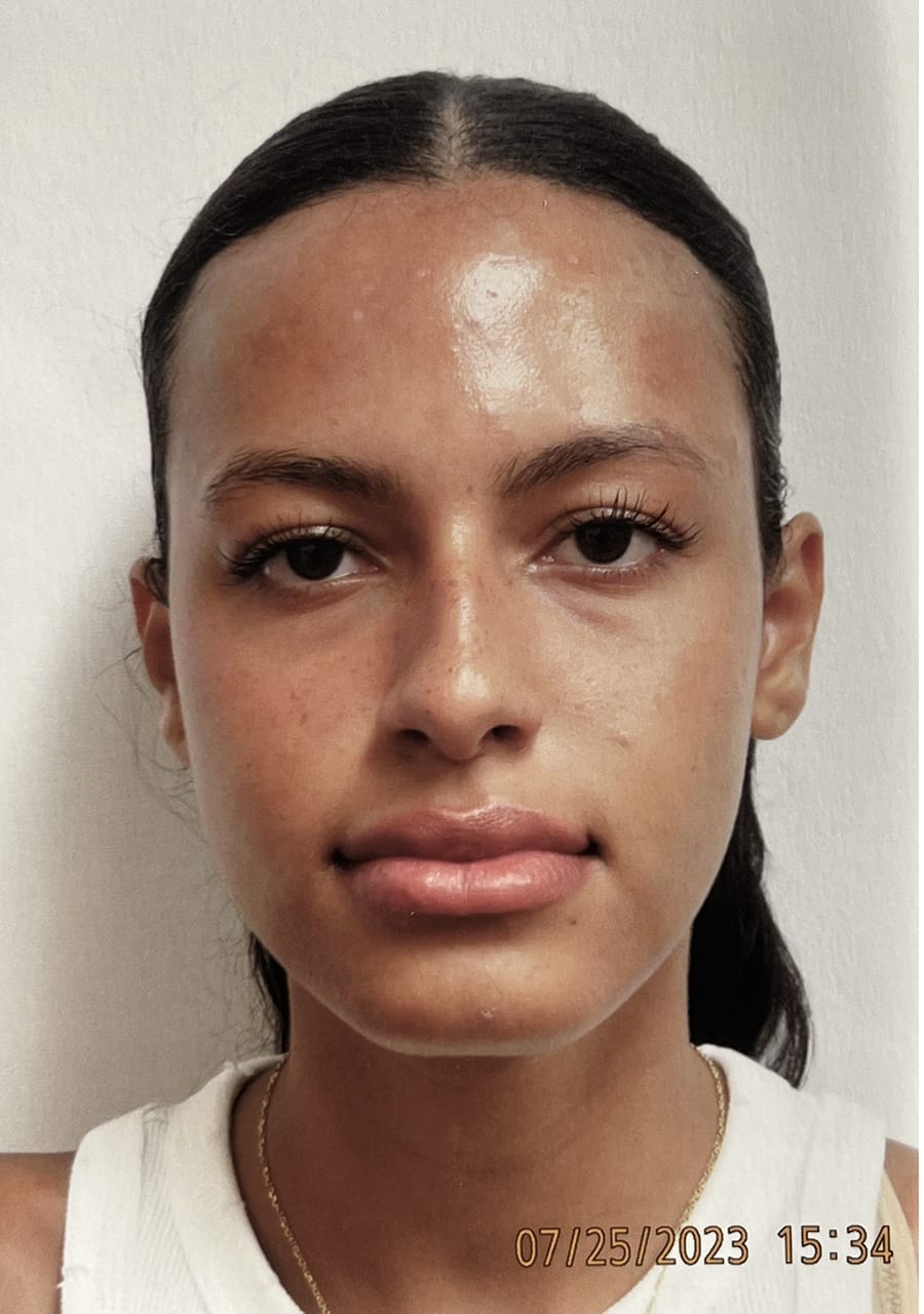 Case Study 143 before