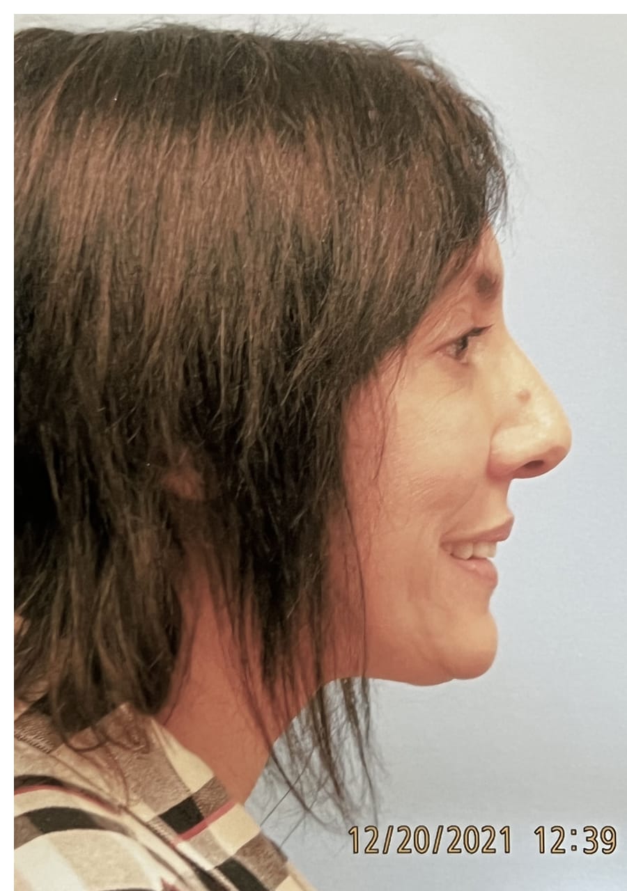 Case Study 156 — before and after