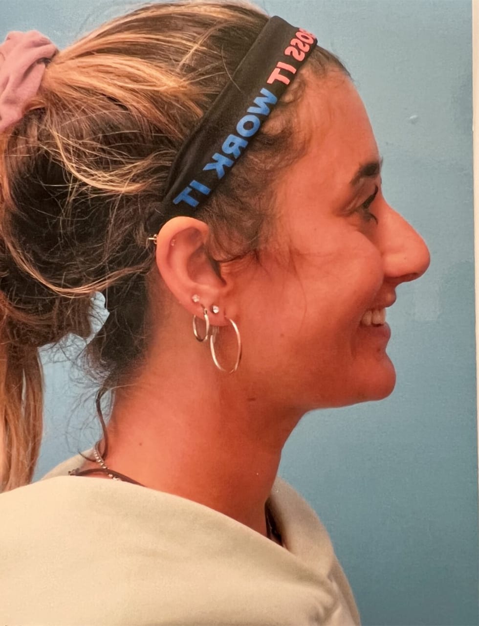 Case Study 53 — before and after