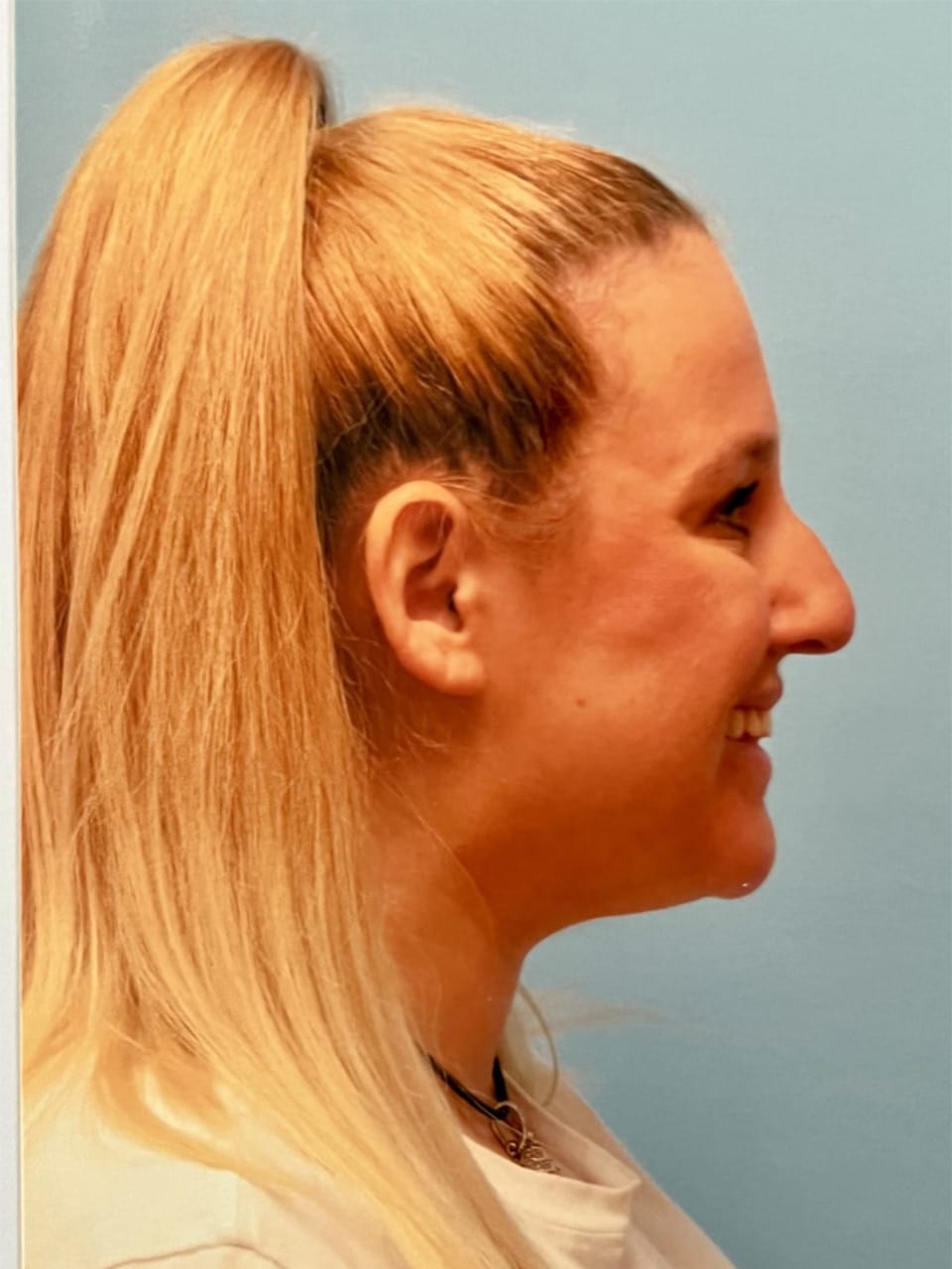 Case study 50 — before and after