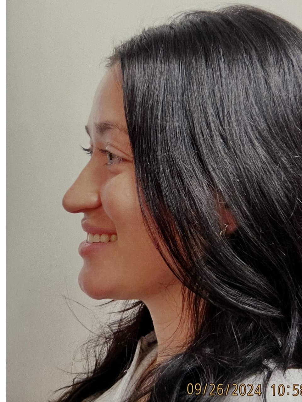 Case Study 249 — before and after