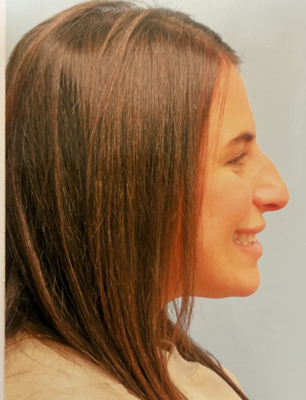 Case Study 54 — before and after
