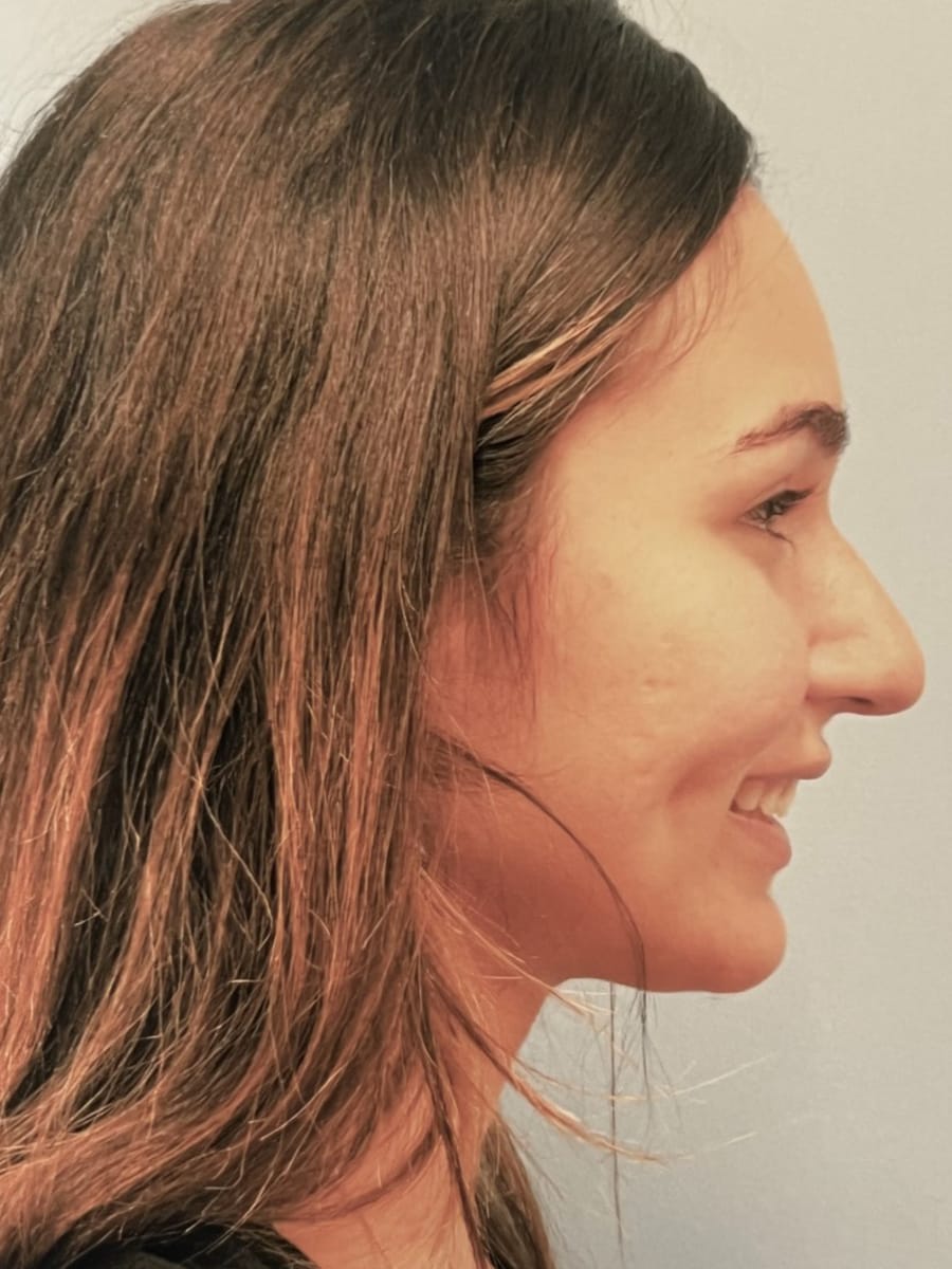 Case Study 65 — before and after