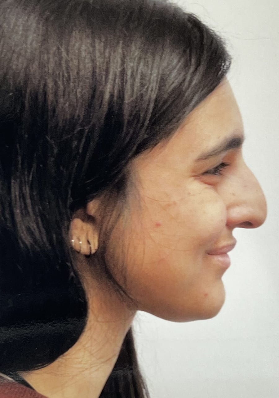 Case Study 115 — before and after
