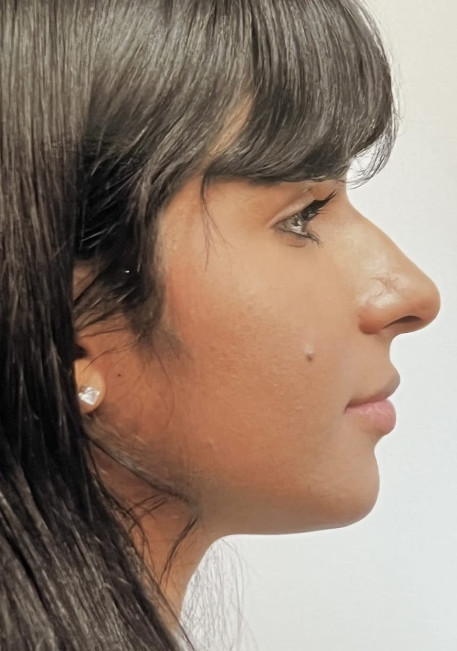 Case Study 121 — before and after
