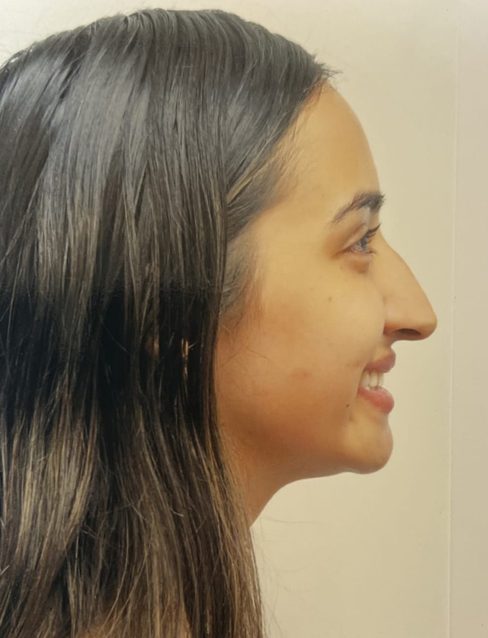 Case Study 71 — before and after