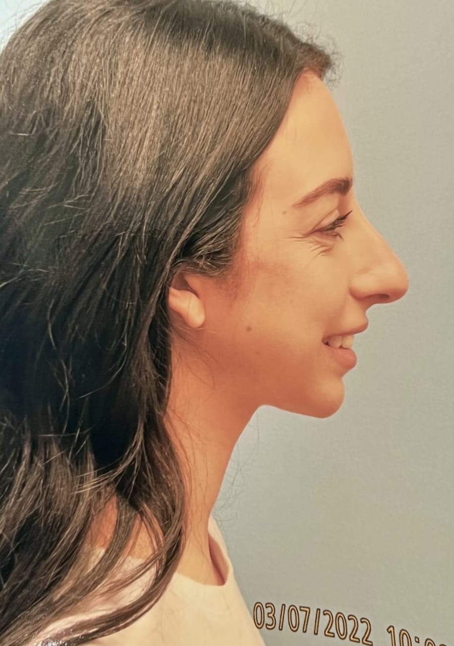 Case Study 63 — before and after