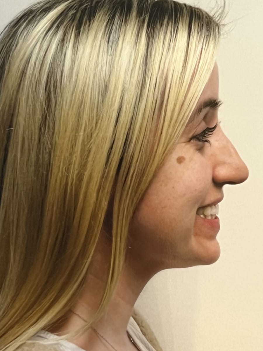Case Study 78 — before and after