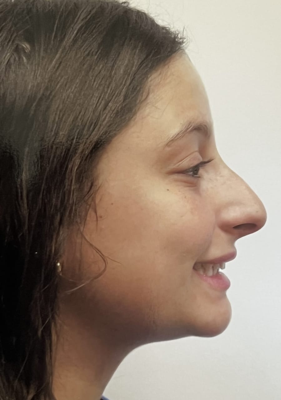 Case Study 123 — before and after