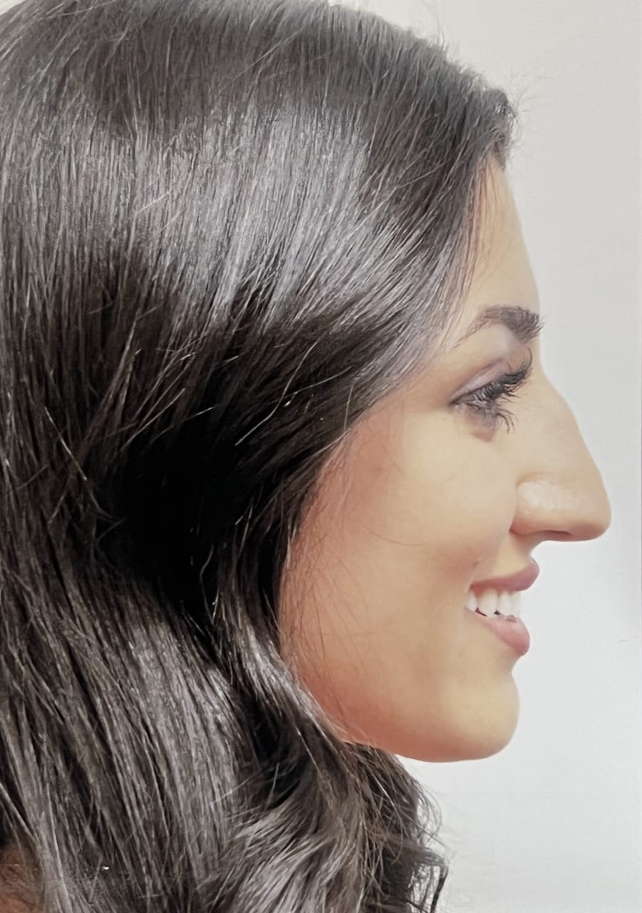 Case Study 100 — before and after