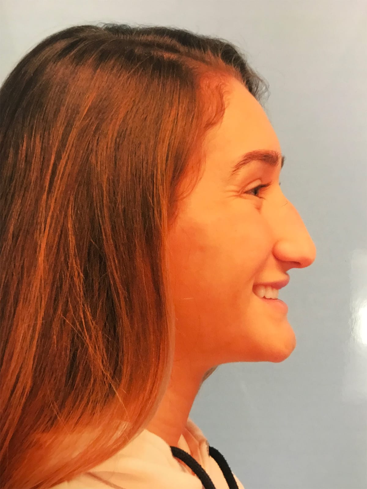 Case Study 9 — before and after