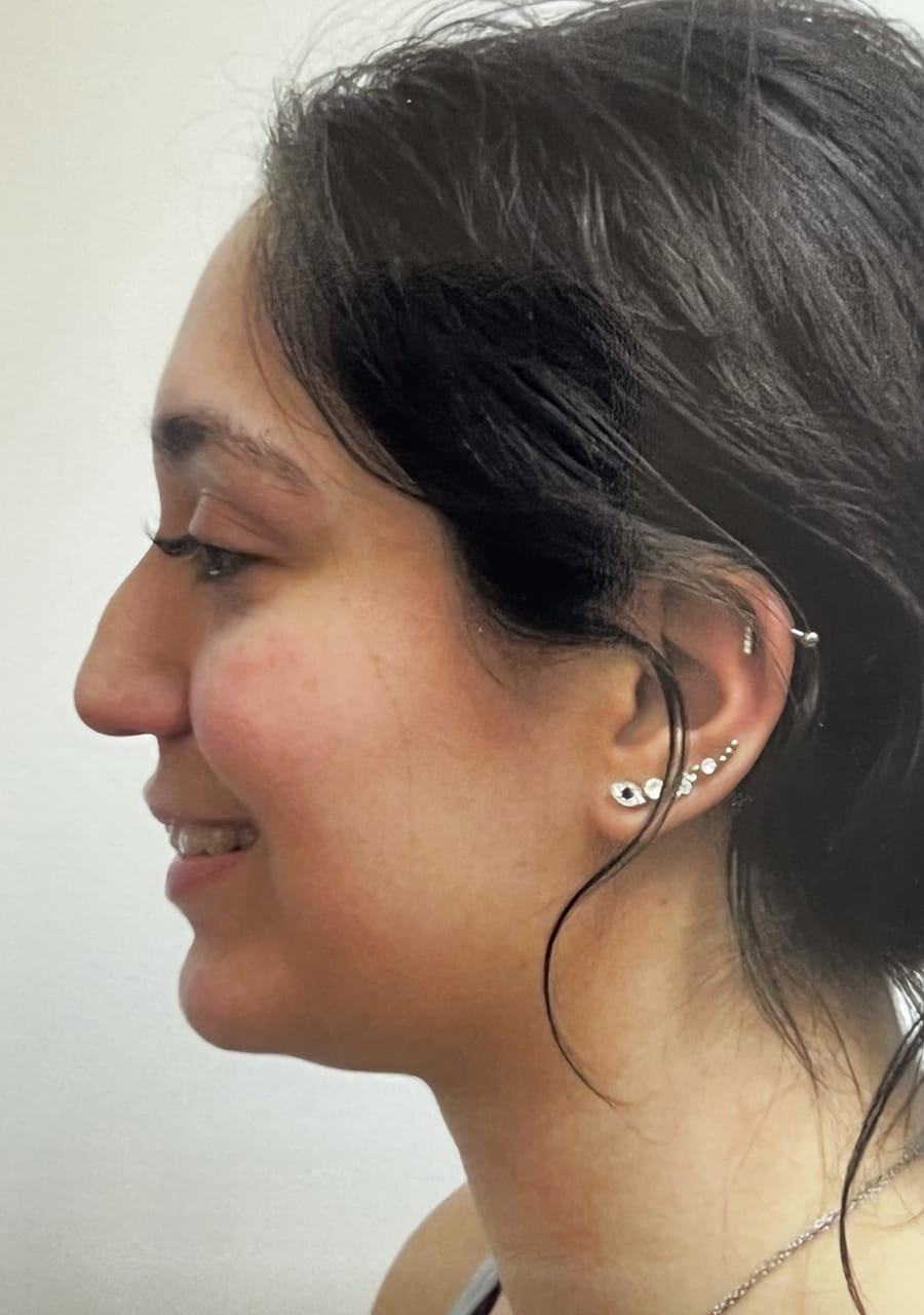 Case Study 104 before