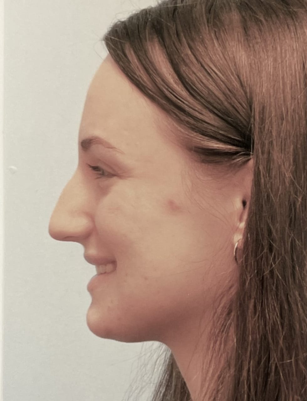 Case Study 60 before