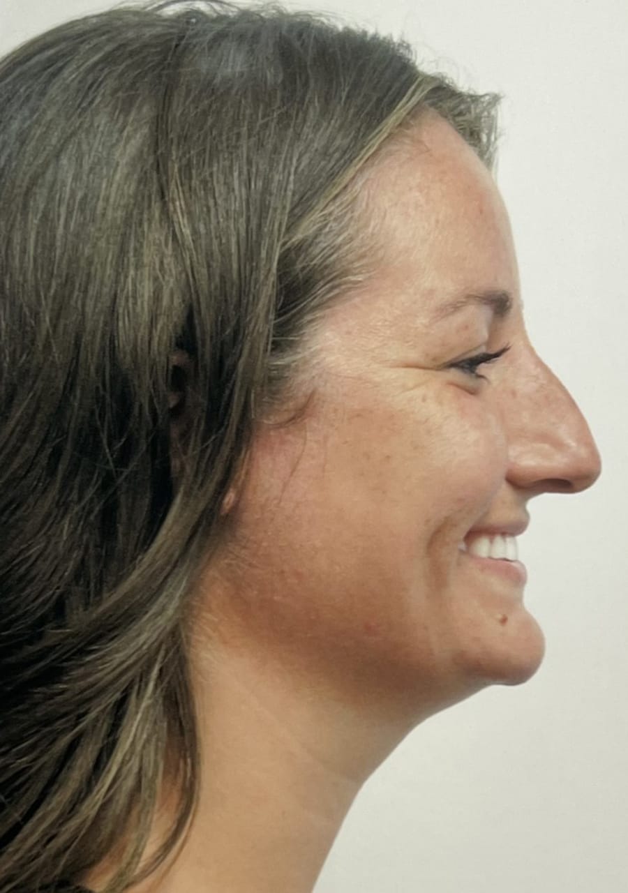 Case Study 82 — before and after