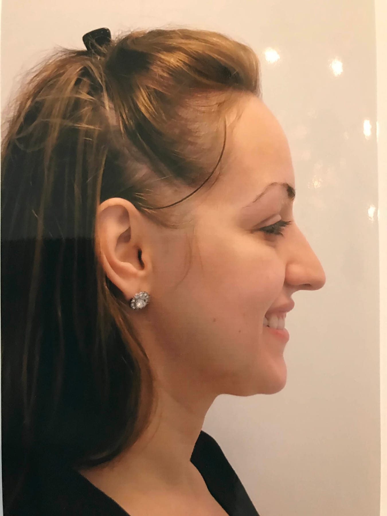 Case Study 25 — before and after