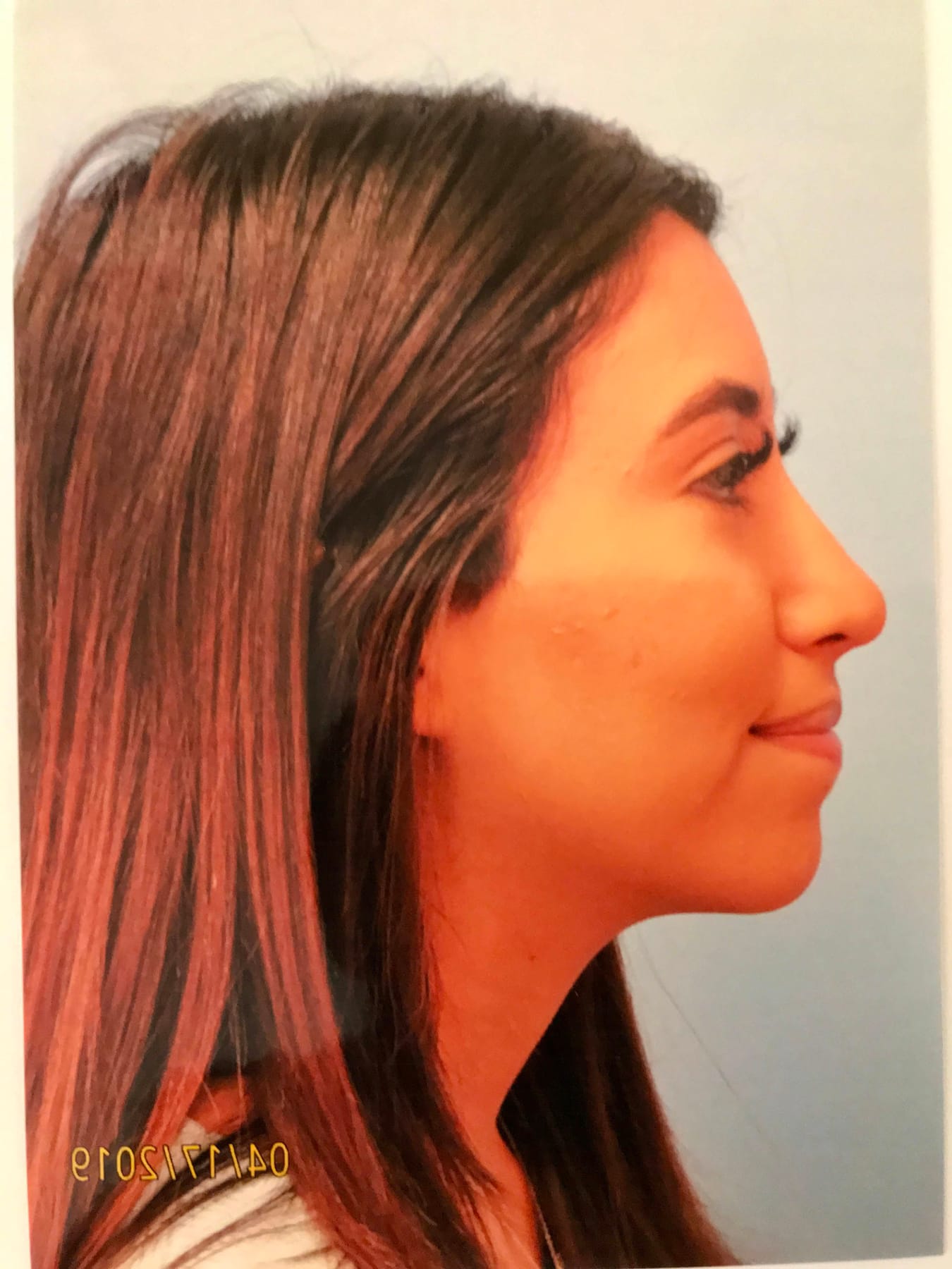 Case Study 17 after