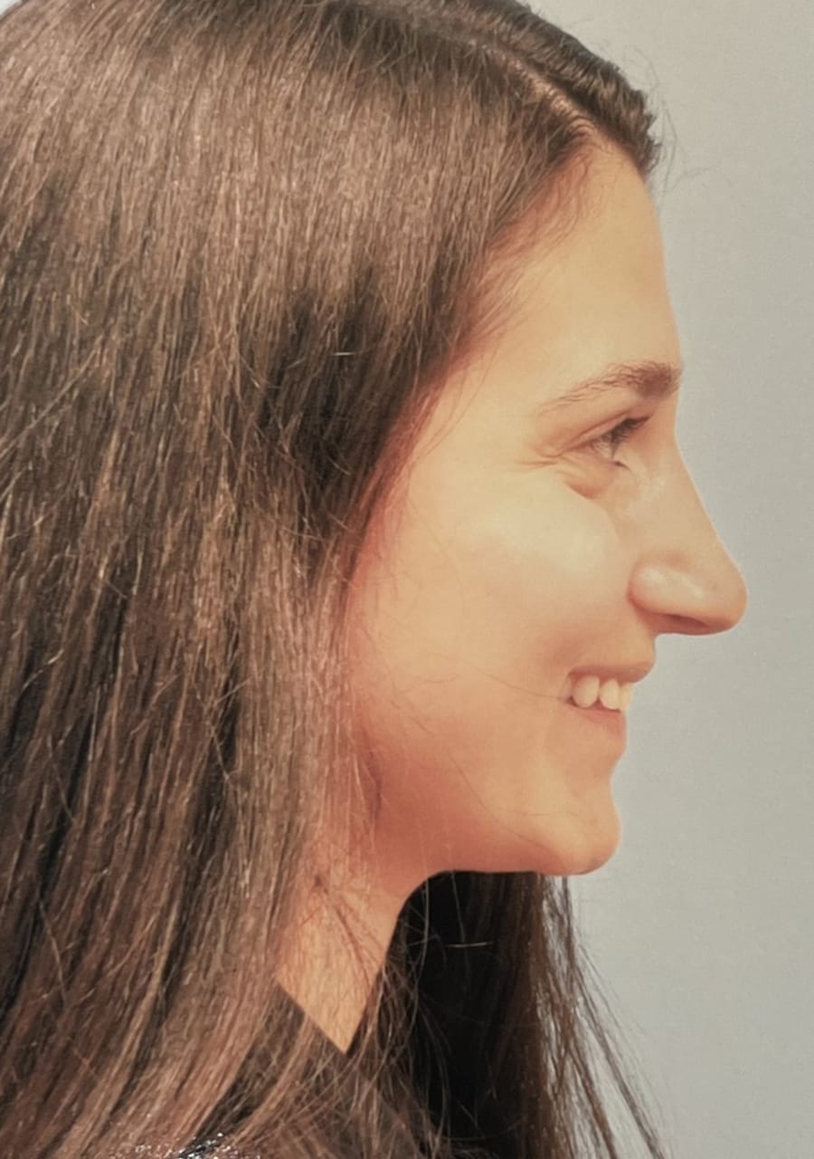 Case Study 68 — before and after