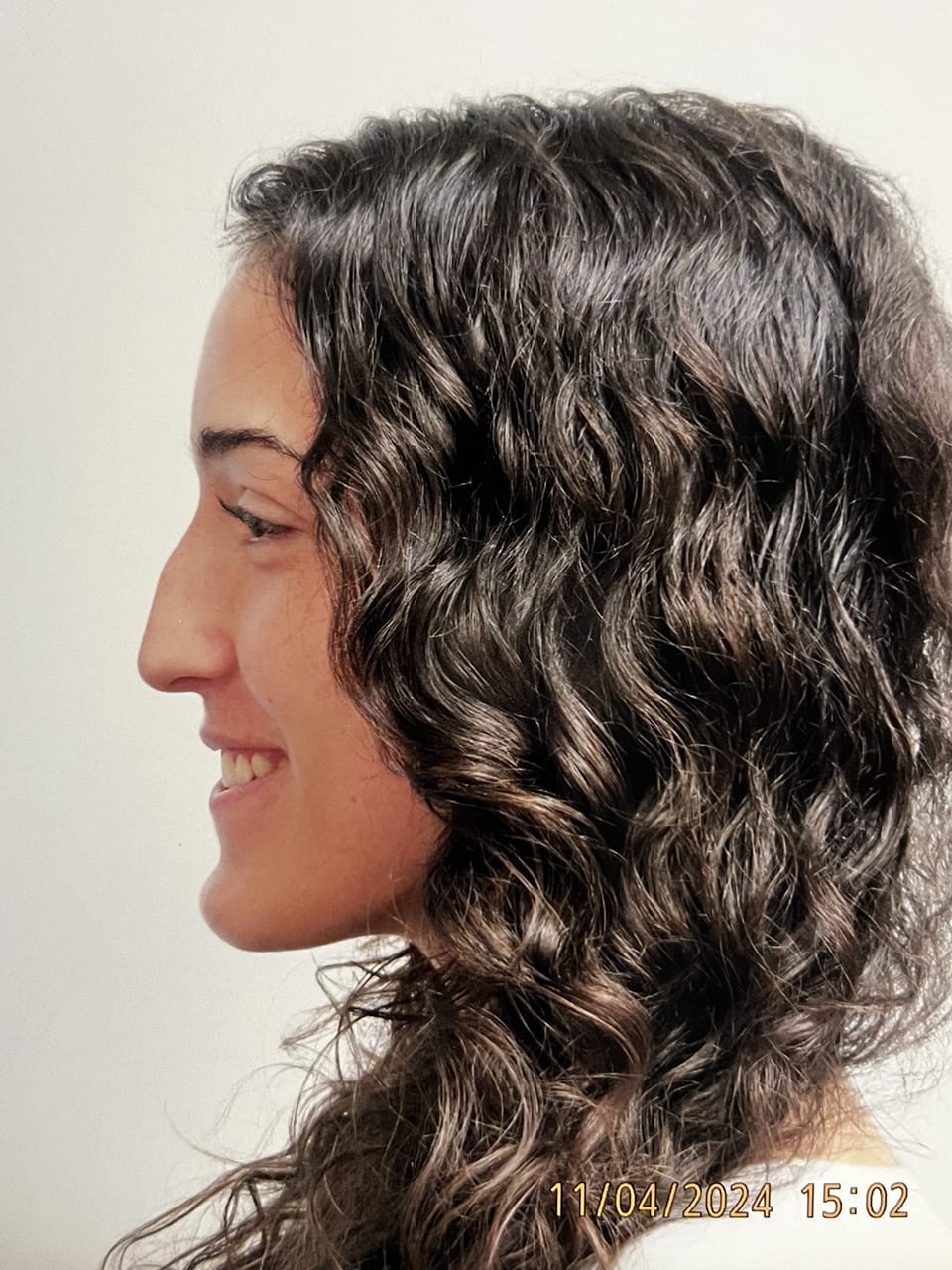 Case Study 258 — before and after