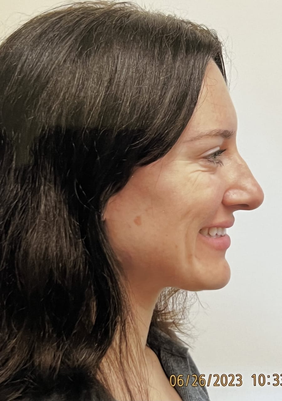 Case Study 137 — before and after