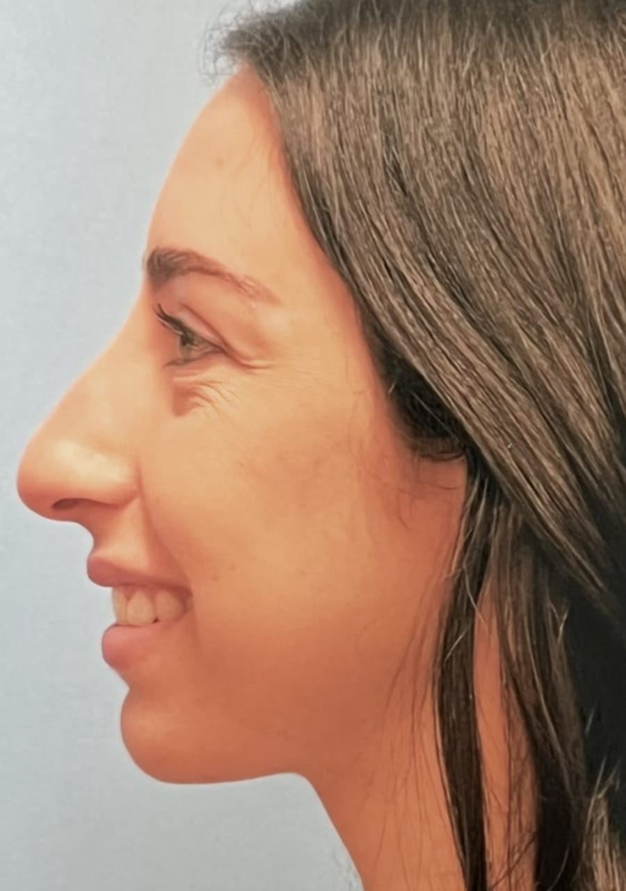 Case Study 63 before