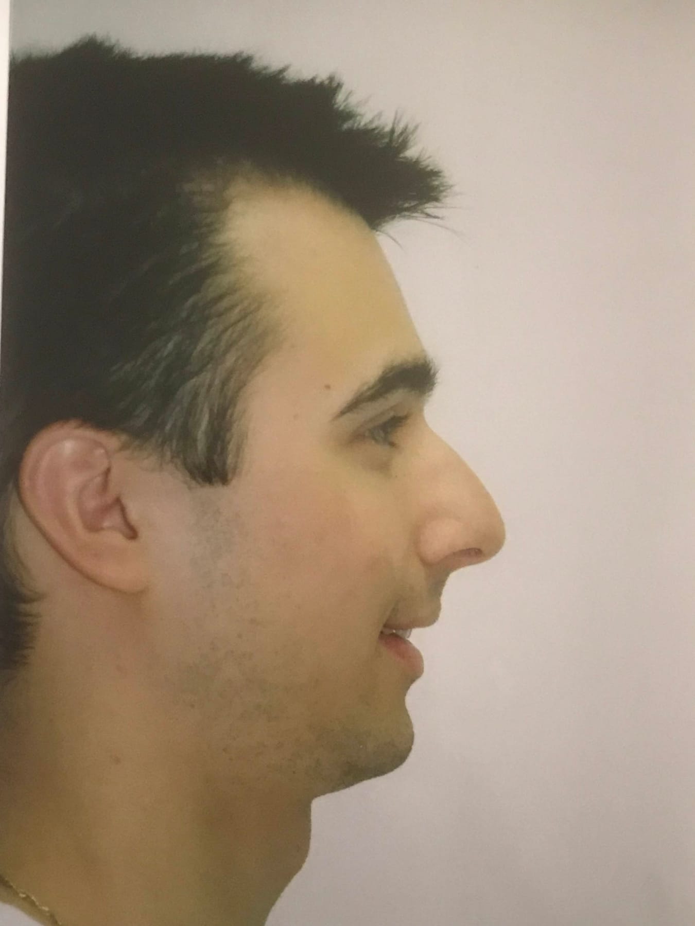 Case Study 36 — before and after
