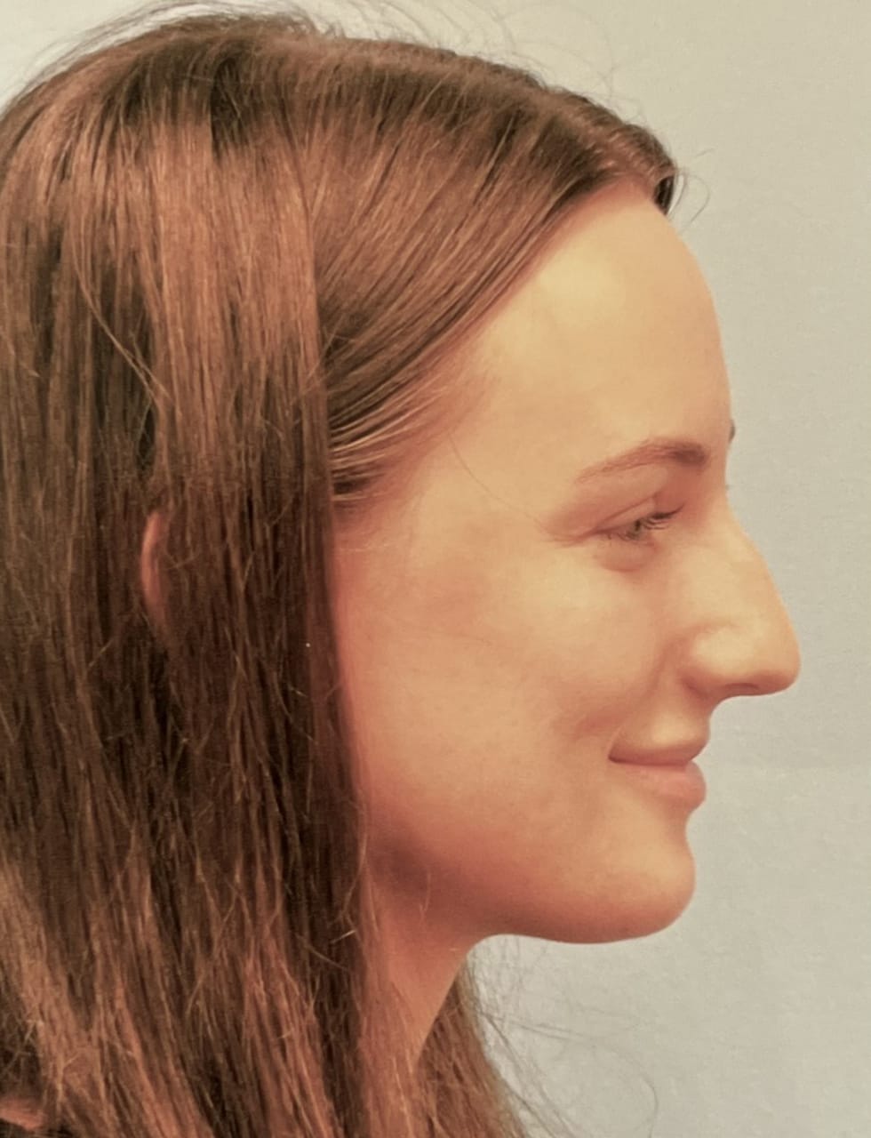 Case Study 60 — before and after
