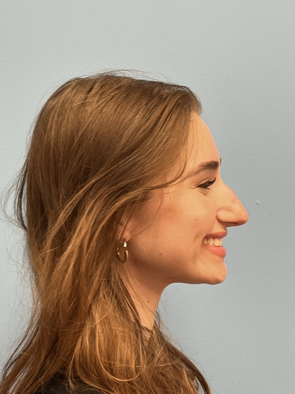 Case Study 57 — before and after