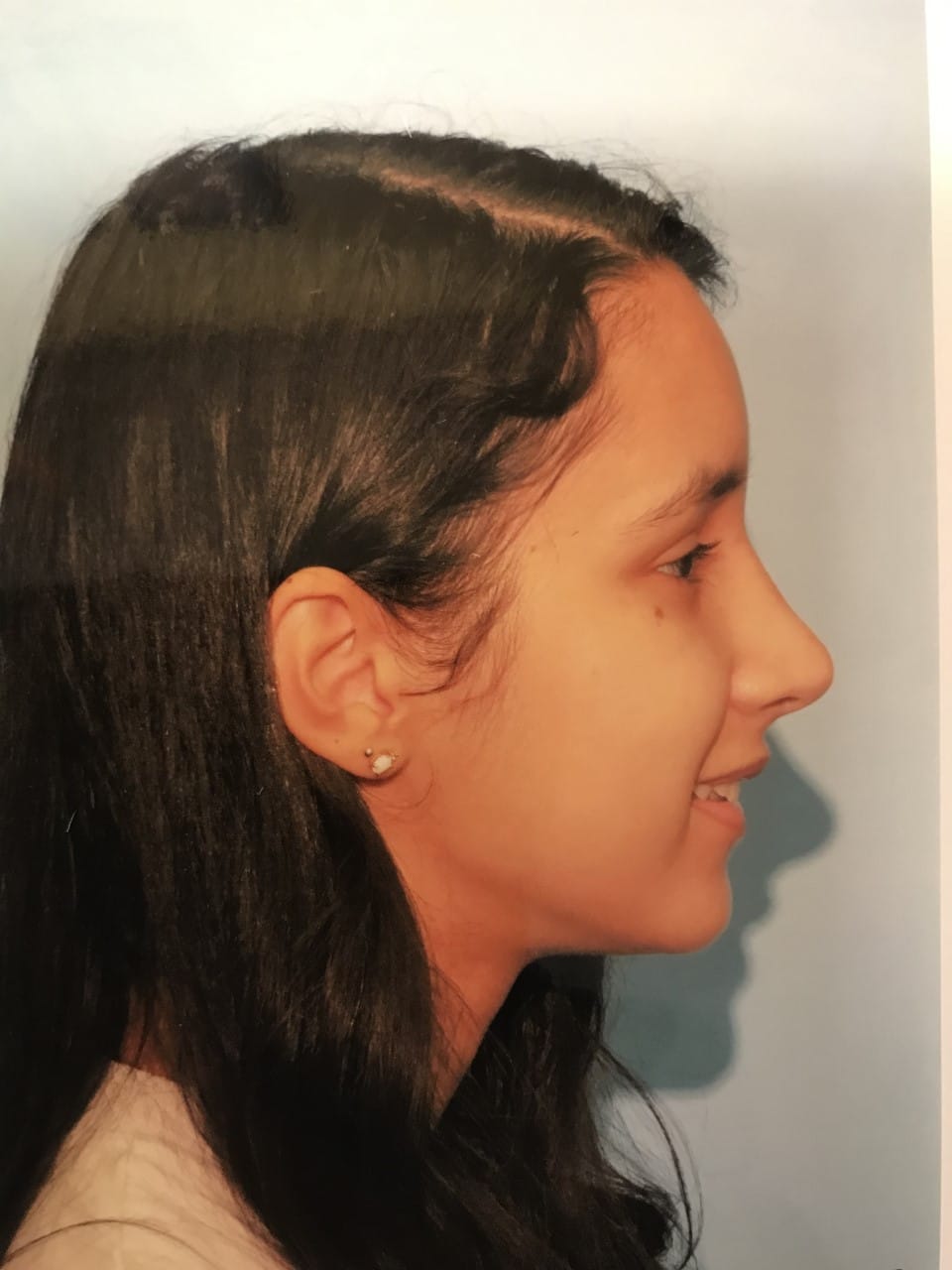 Case Study 18 after