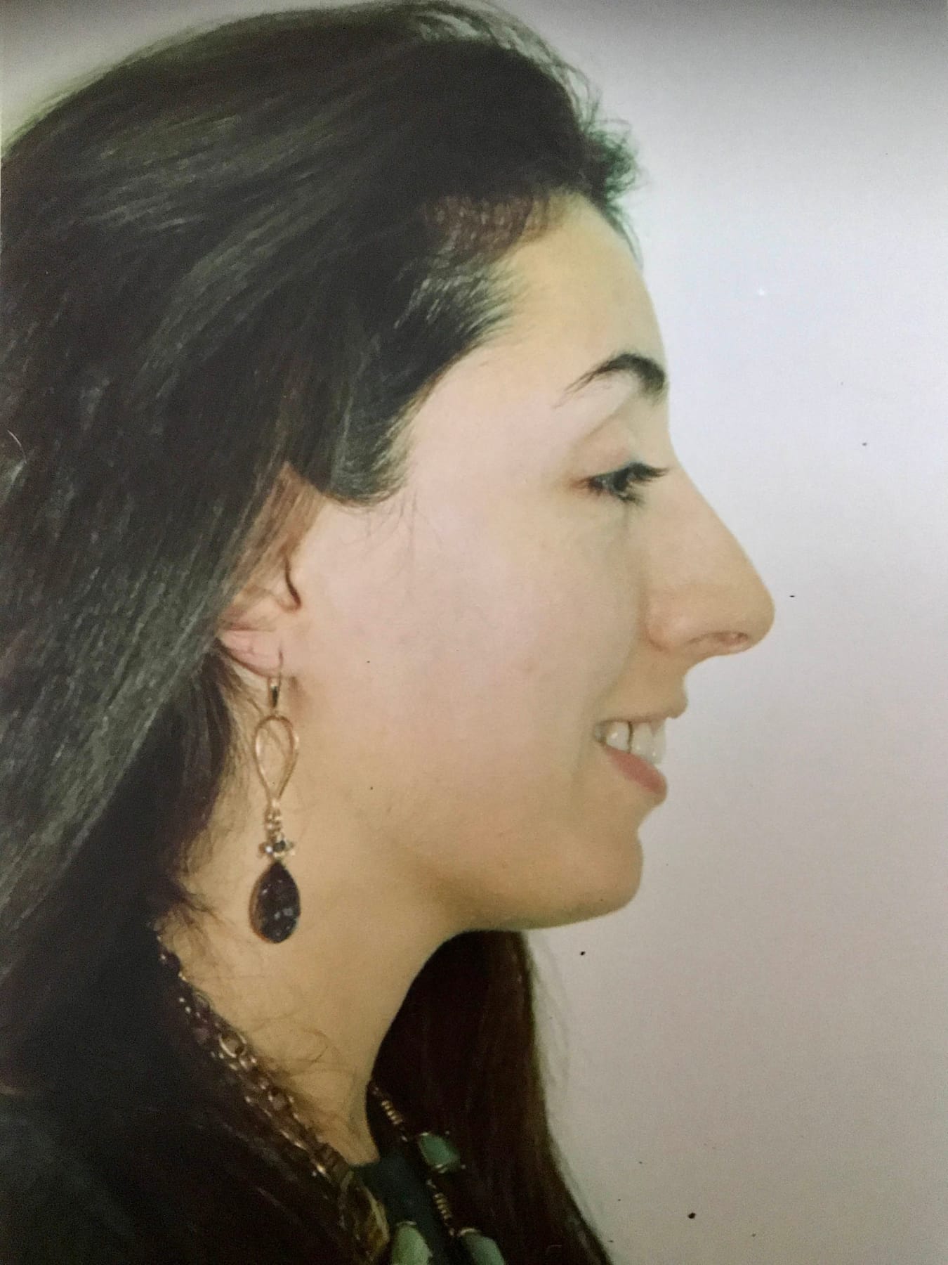 Case Study 42 — before and after
